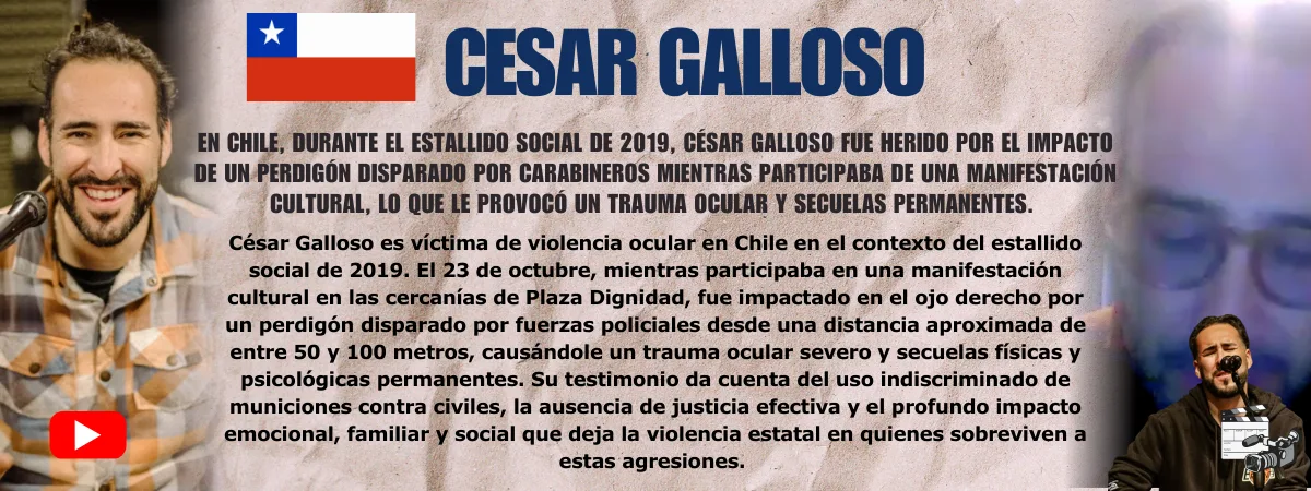 Cesar Galloso Testimonio de Cesar Galloso — víctima de violencia ocular policial