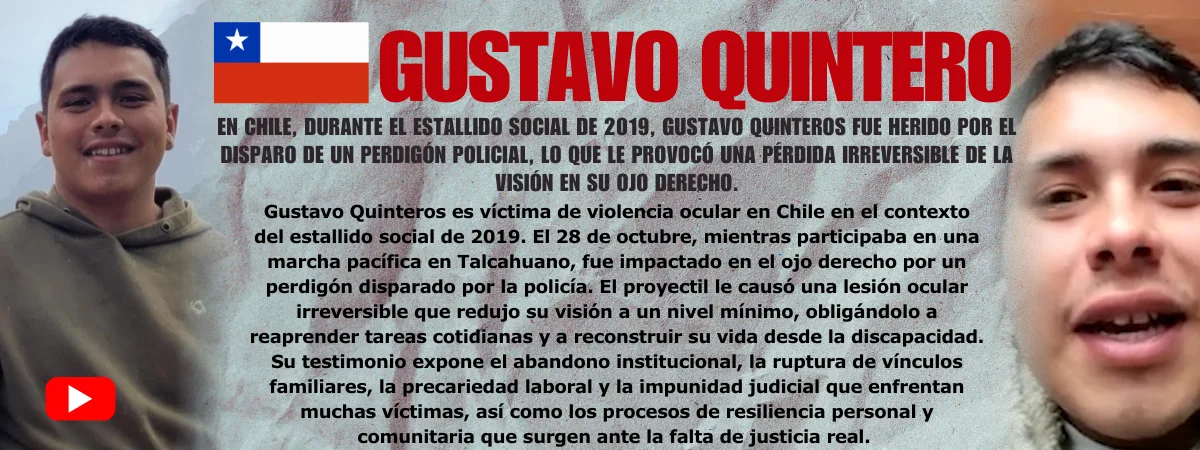 Gustavo Quintero Testimonio de Gustavo Quintero — víctima de violencia ocular policial