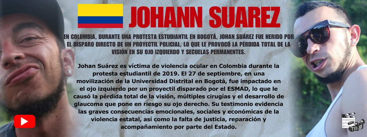 Johann Suarez Testimonio de Johann Suarez — víctima de violencia ocular policial