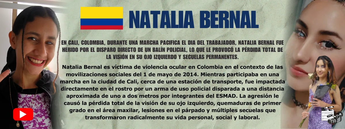 Natalia Bernal Testimonio de Natalia Bernal — víctima de violencia ocular policial