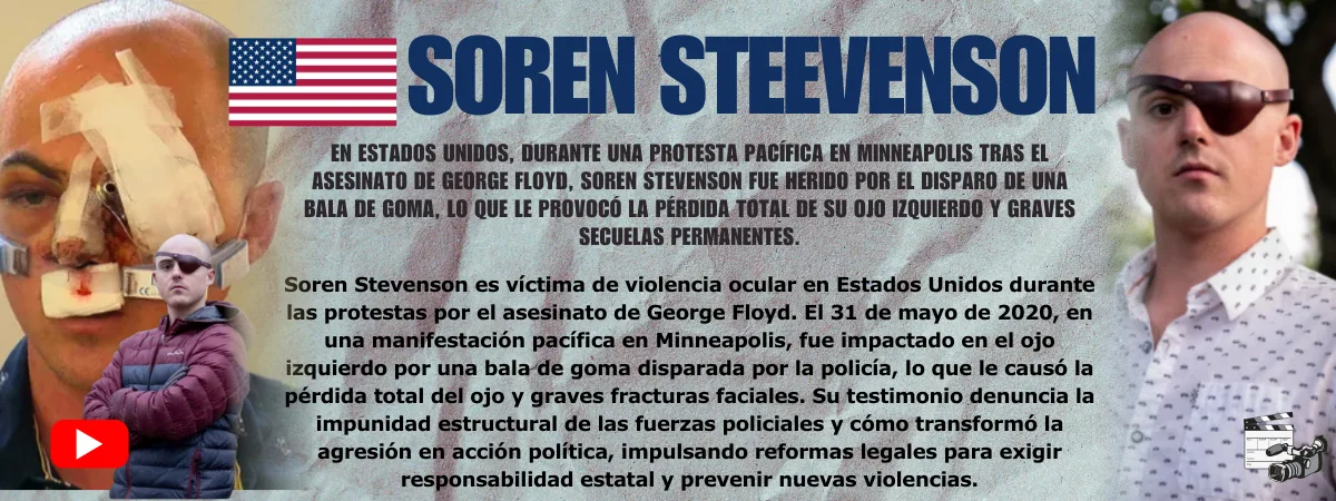 Soren Steevenson Testimonio de Soren Steevenson — víctima de violencia ocular policial