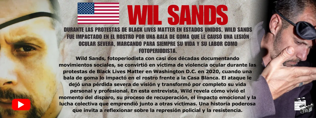 Wil Sands Testimonio de Wil Sands — víctima de violencia ocular policial